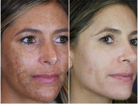 SKCLEAN Anti-ageing Body & Face Cleansing Exfoliating Gel